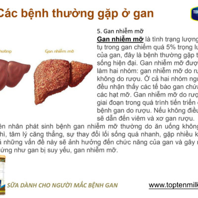 Sữa dinh dưỡng cho gan ,mát gan giải độc liver gold 800g topten milk