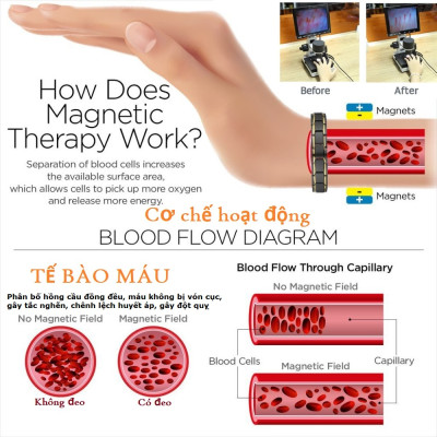 Vòng Điều Hòa Huyết Áp Nhật Bản, Ngừa Đột Quỵ, Giúp khí huyết lưu thông, ngủ ngon hơn