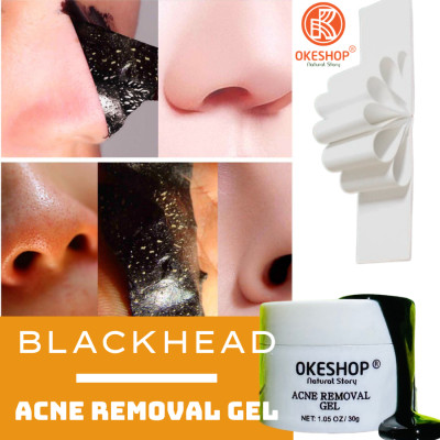 Gel Lột Mụn Than Tre Hoạt Tính OKESHOP 30ml - Giải Pháp Loại Bỏ Mụn Đầu Đen - Mụn Cám - Bạ Nhờn - Làm Sạch Sâu Và Thu Nhỏ Lỗ Chân Lông