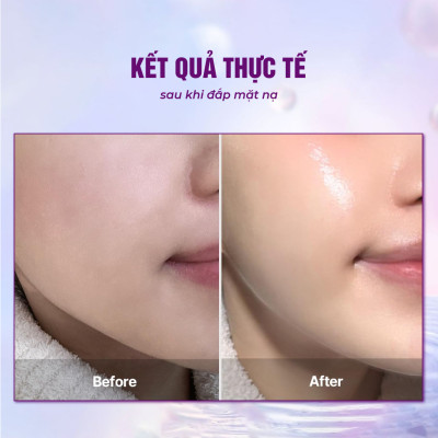 [Set Đỏ kiêu sa] Combo 10 Mặt nạ BESKINATY hỗ trợ phục hồi dưỡng da chuyên sâu