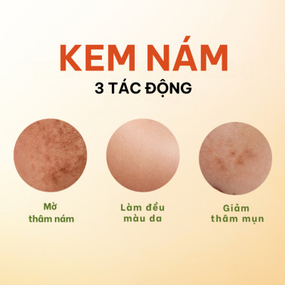 Kem nám Bimore_dưỡng da sáng mịn, giảm mờ thâm nám, tàn nhan_30ml