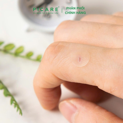 Miếng dán mụn che khuyết điểm và giảm mụn Elaband Hydro Dot Proposal