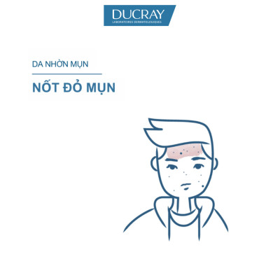 Kem ngừa mụn viêm & thâm chuyên biệt dành cho da nhờn, tổn thương Ducray Keracnyl PP+ Anti-Blemish Cream 30ml