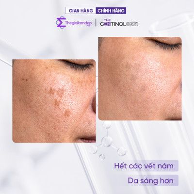 Kem Mela Off tái sinh tế bào, khôi phục sự cân bằng da The Gentinol 0221 50g