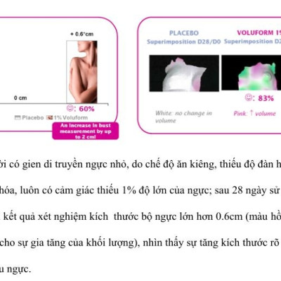 Hộp 10 miếng dán tăng vòng 1, săn chắc, chống chảy xệ Rainbow L