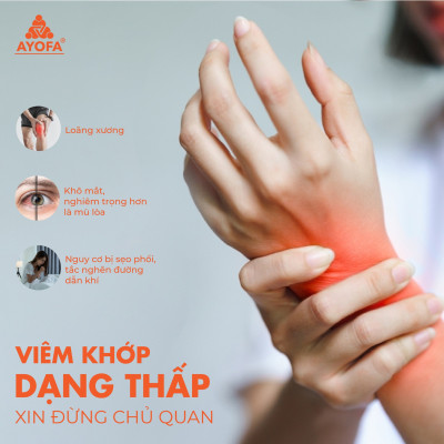 Viên uống hỗ trợ bảo vệ xương khớp, tái tạo sụn Ayofa Bone 45 viên/ Hộp