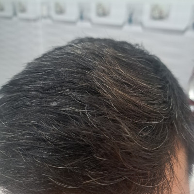 Thuốc Duỗi Đa Năng ARGININ 500ML