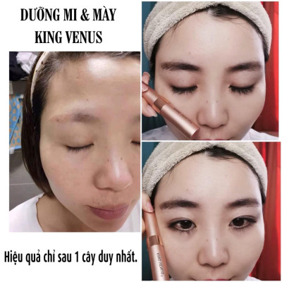 [Date 2027] Combo 02 Serum Dưỡng Mi và Mày King Venus: Cung cấp dưỡng chất nuôi dưỡng lông mi và mày. Dưỡng mi dài và dày chỉ sau liệu trình 1 cây. Cam kết hoàn tiền nếu không hiệu quả