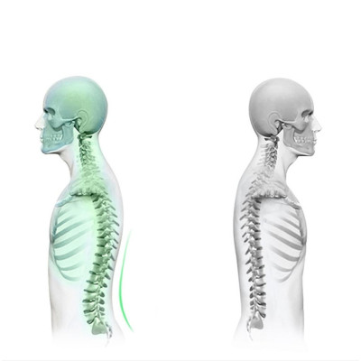 Khung Nắn Chỉnh Cột Sống, Định Hình Cột Sống, Phòng Thoát Vị Đĩa Đệm, Đau Lưng, Dụng Cụ Hỗ Trợ Tập Lưng - Chính Hãng miDoctor