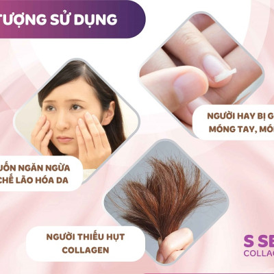 [DATE T11.2025] Combo 3 Hộp Nước Uống Đẹp Da Collagen S Select Nhật Bản Liệu Trình Trẻ Hóa, Dưỡng Sáng Da Hoàn Hảo (30 Lọ)