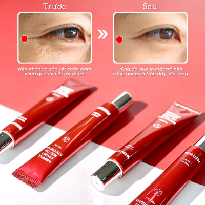 Kem dưỡng mắt giảm mờ thâm quầng mắt Retinol Pretty Skin, cải thiện nếp nhăn Prettyskin Wrinkle eraser roll on eye cream