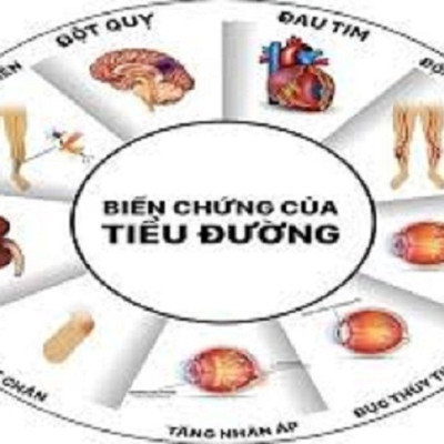 NHÀU RỪNG KHÔ NGUYÊN CHẤT MẸ KEN (NONI) (500gr)