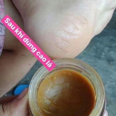 Combo kem bôi da thuần mộc & cao lá trị rạn nứt nẻ da Thanh Mộc Hương 50g